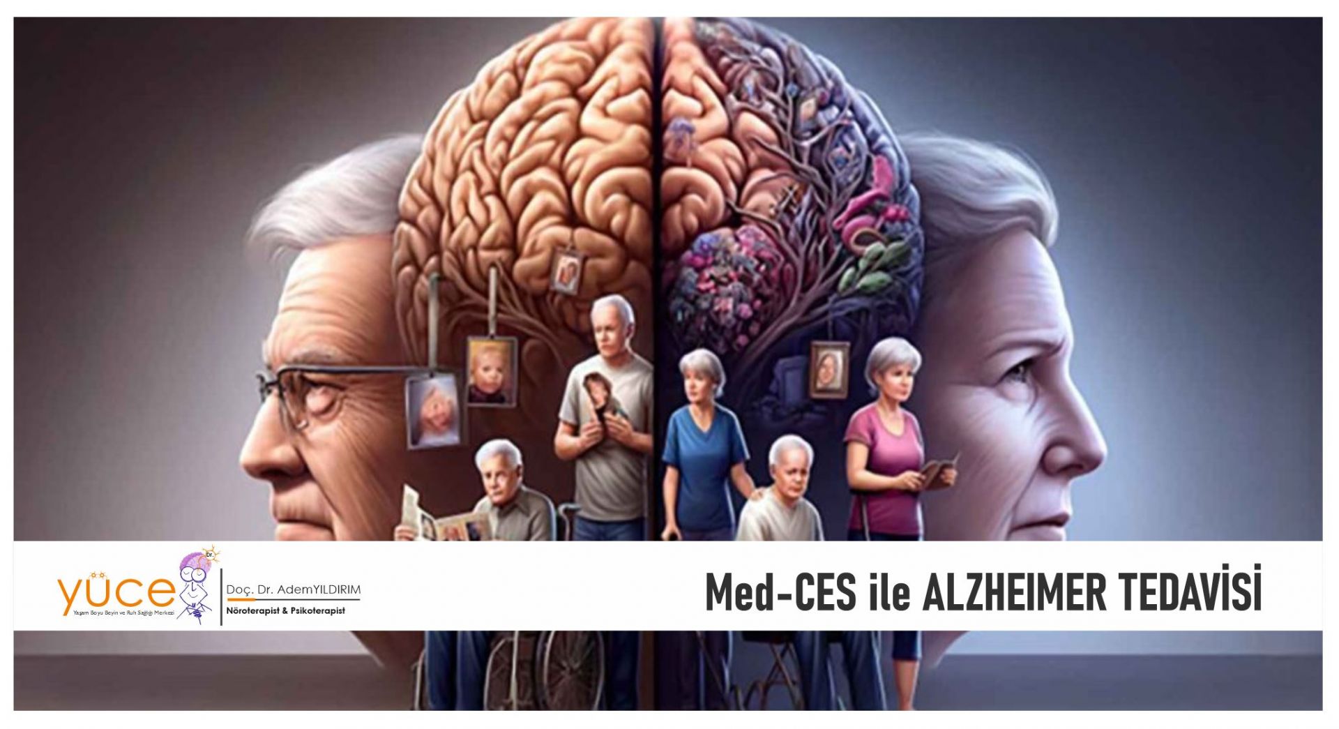 What Alzheimer's? Alzheimer's Treatment?